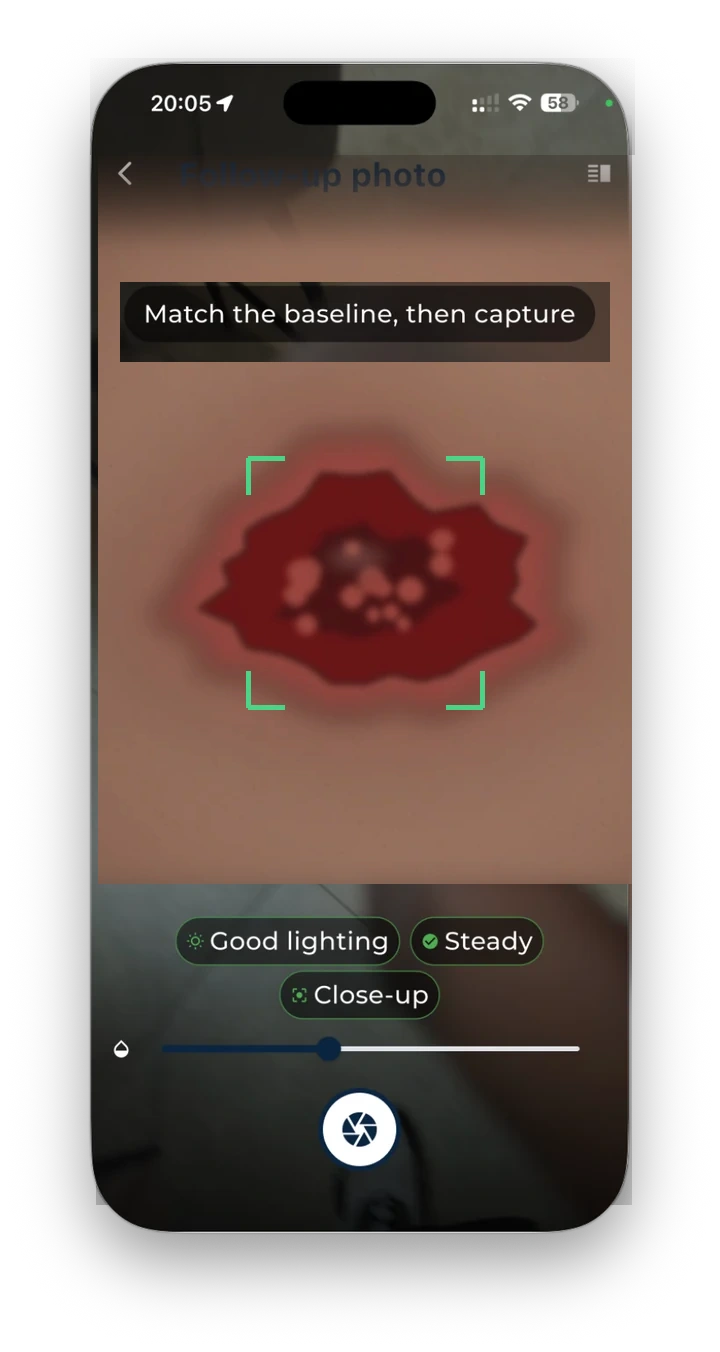 Mobile screen showing guided wound photograph capture