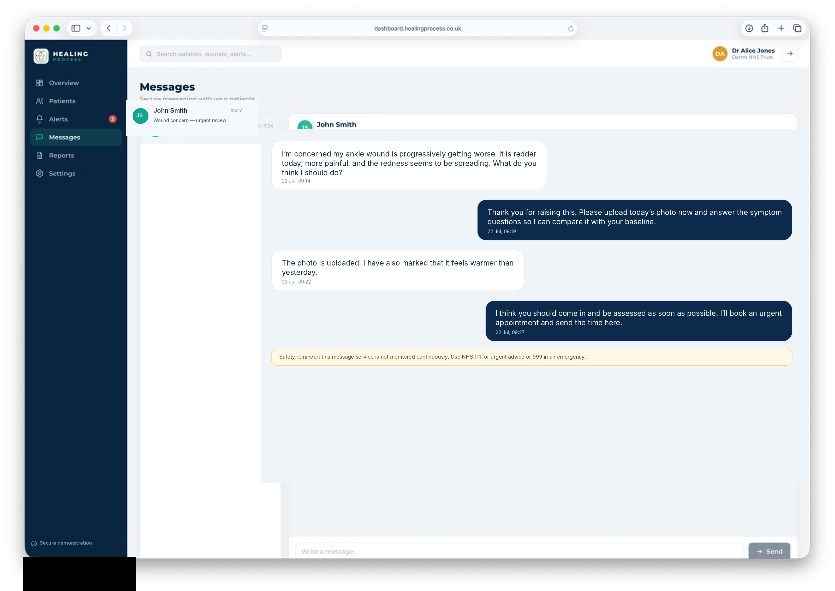 Clinician dashboard showing a meaningful wound concern conversation